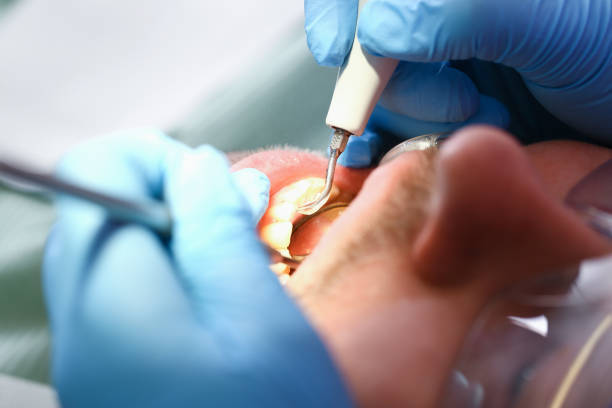 Best Emergency Dental Care for Trauma or Injury in Pigeon Forge, TN