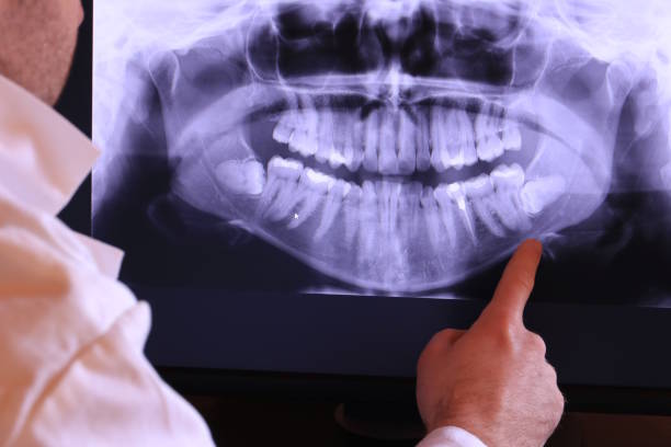 Best After-Hours Emergency Dentist in Pigeon Forge, TN